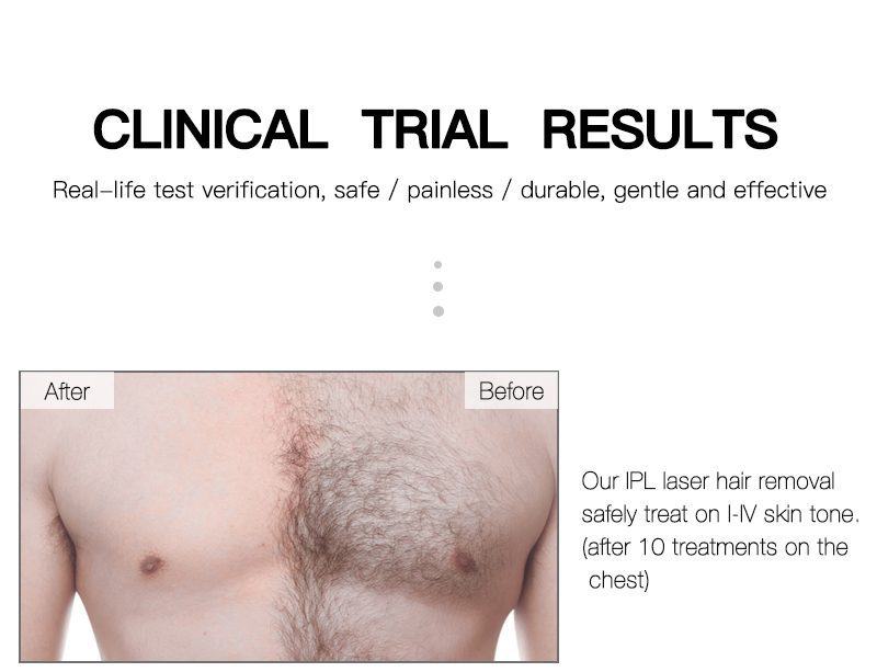 600000 flash professional permanent IPL epilator laser hair removal electric photo women painless threading hair remover machine