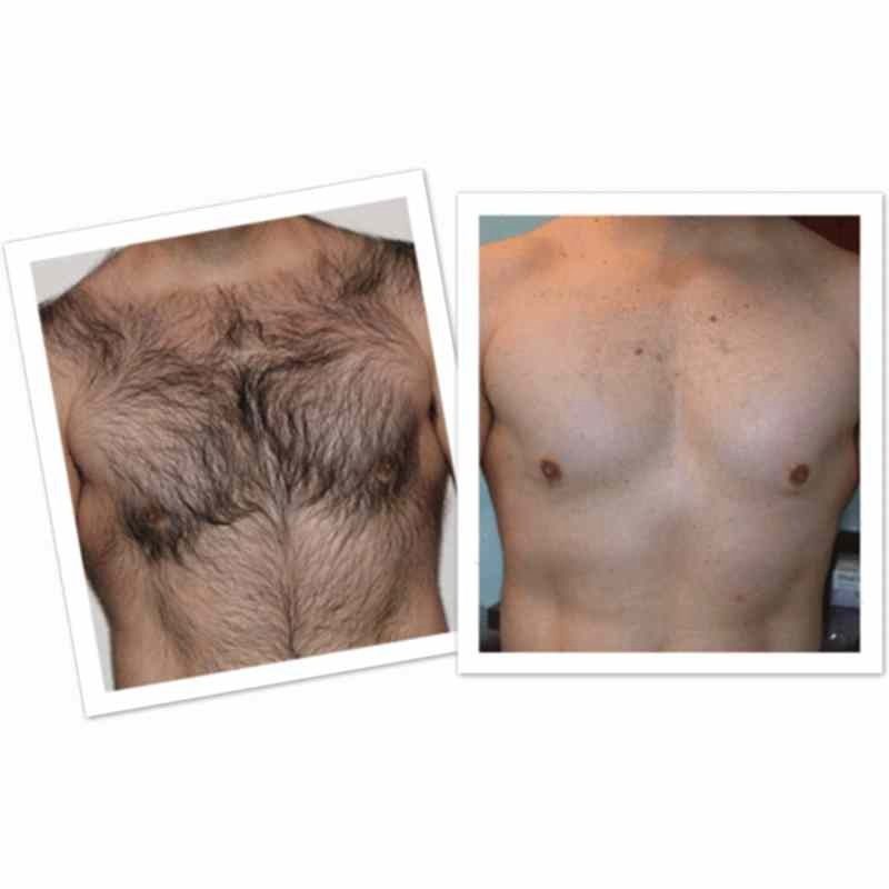 1PCS/2PCS/3PCS/4PCS/5PCS Smooth Body Hair Removal Spray PRE & After Wax Treatment Spray 1PCS/2PCS/3PCS/4PCS/5PCS Smooth Body Hair Removal Spray PRE & After Wax Treatment Spray