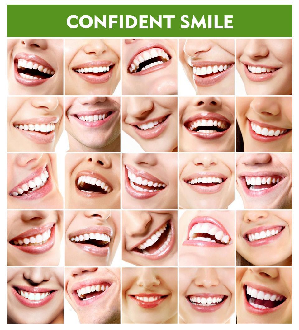 VIBRANT GLAMOUR Teeth Whitening Pen Cleaning Serum Remove Plaque Stains Dental Tools Oral Hygiene Tooth Gel WhitenningToothpaste