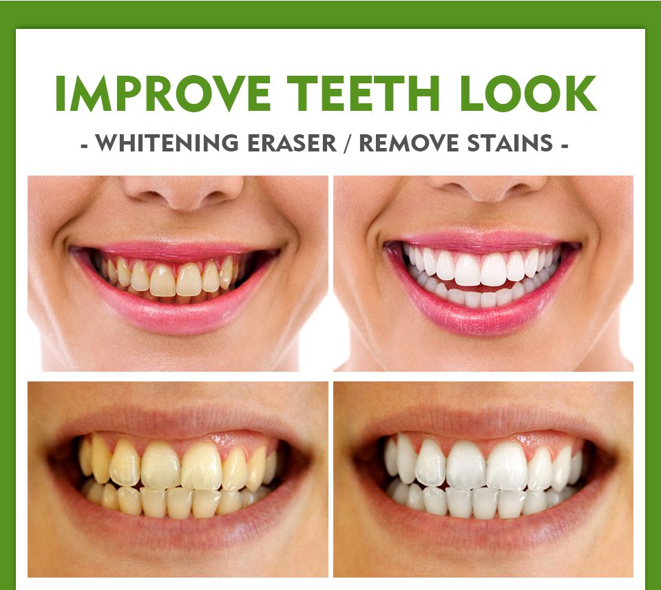 VIBRANT GLAMOUR Teeth Whitening Pen Cleaning Serum Remove Plaque Stains Dental Tools Oral Hygiene Tooth Gel WhitenningToothpaste