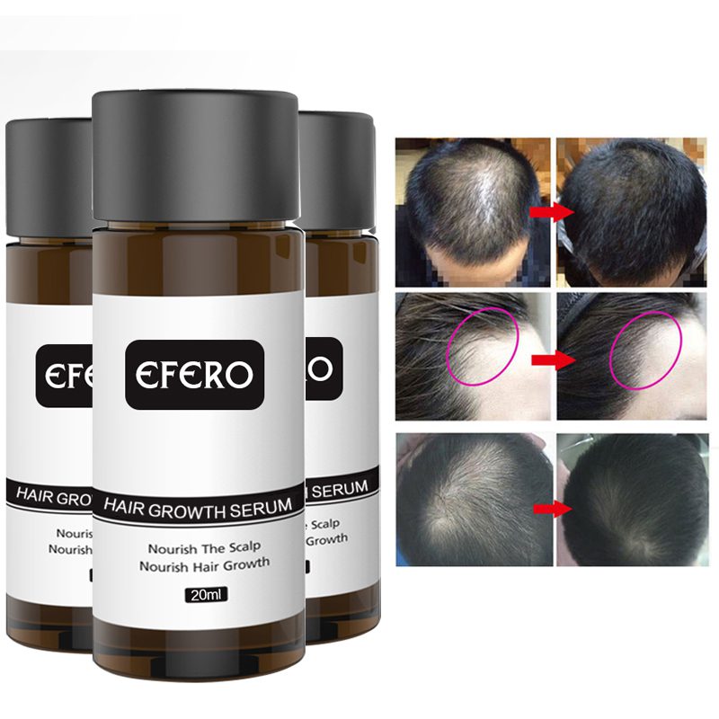 Hair Growth Essence Hair Loss Dense Hair Fast Hair Growth Oil Grow Restoration Growing Serum