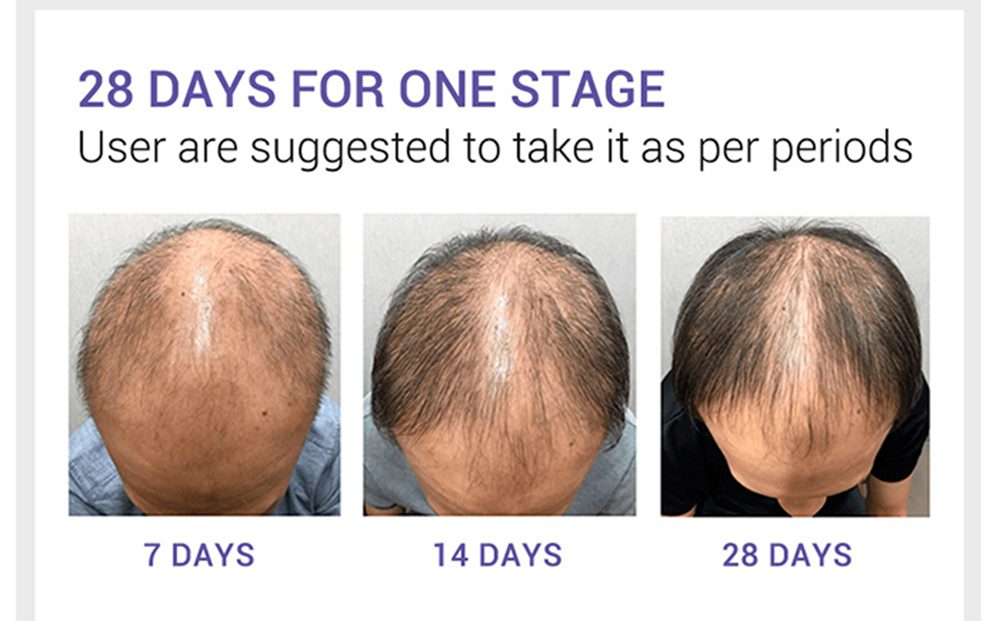 Hair Care Hair Growth Essential Oils Essence Original Authentic 100% Hair Loss Liquid Health Care Beauty Dense Hair Growth Serum Hair Care Hair Growth Essential Oils Essence Original Authentic 100% Hair Loss Liquid Health Care Beauty Dense Hair Growth Serum