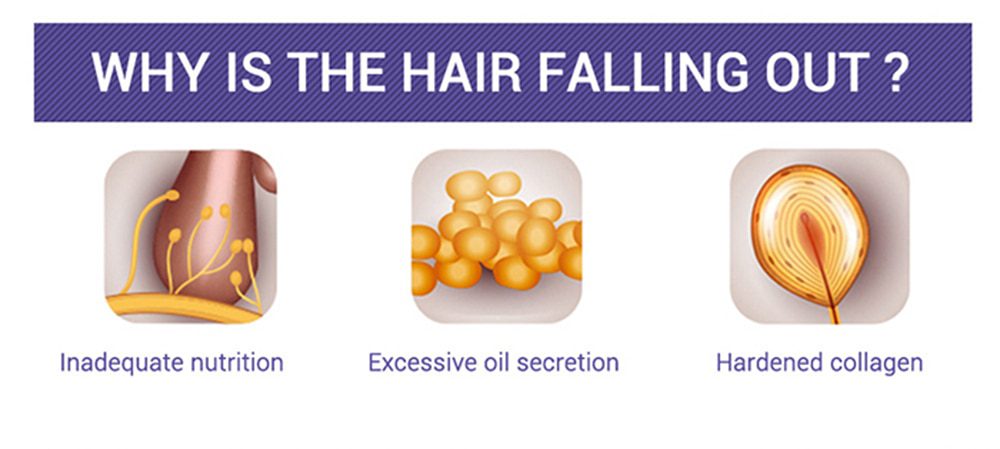Hair Care Hair Growth Essential Oils Essence Original Authentic 100% Hair Loss Liquid Health Care Beauty Dense Hair Growth Serum Hair Care Hair Growth Essential Oils Essence Original Authentic 100% Hair Loss Liquid Health Care Beauty Dense Hair Growth Serum