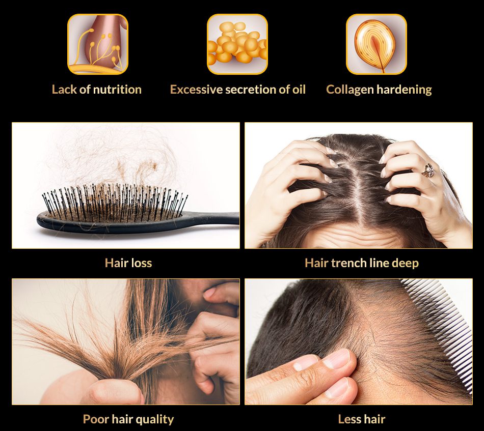 OMY LADY Anti Hair Loss Hair Growth Spray Essential Oil Liquid For Men Women Dry Hair Regeneration Repair,Hair Loss Products OMY LADY Anti Hair Loss Hair Growth Spray Essential Oil Liquid For Men Women Dry Hair Regeneration Repair,Hair Loss Products