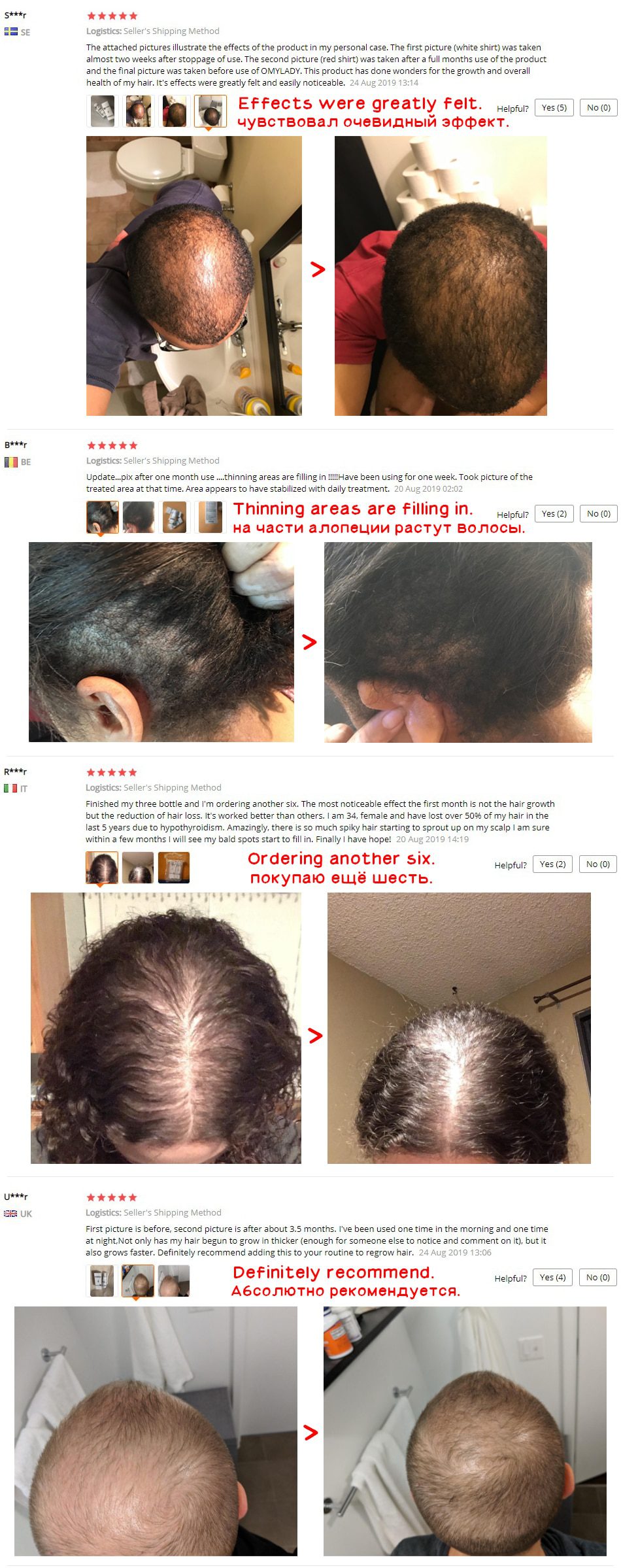 OMY LADY Anti Hair Loss Hair Growth Spray Essential Oil Liquid For Men Women Dry Hair Regeneration Repair,Hair Loss Products OMY LADY Anti Hair Loss Hair Growth Spray Essential Oil Liquid For Men Women Dry Hair Regeneration Repair,Hair Loss Products