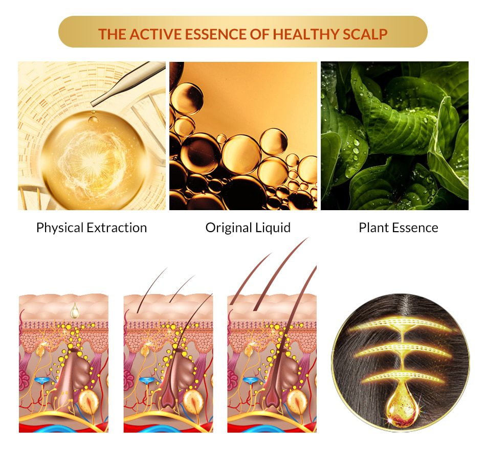 OMY LADY Anti Hair Loss Hair Growth Spray Essential Oil Liquid For Men Women Dry Hair Regeneration Repair,Hair Loss Products OMY LADY Anti Hair Loss Hair Growth Spray Essential Oil Liquid For Men Women Dry Hair Regeneration Repair,Hair Loss Products