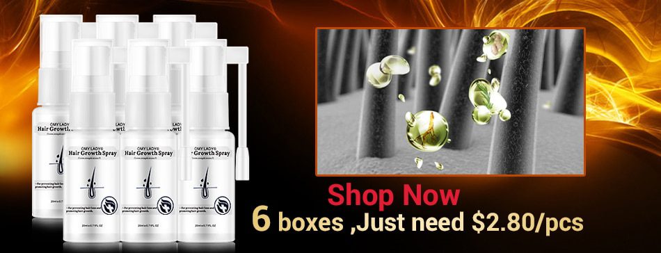 OMY LADY Anti Hair Loss Hair Growth Spray Essential Oil Liquid For Men Women Dry Hair Regeneration Repair,Hair Loss Products OMY LADY Anti Hair Loss Hair Growth Spray Essential Oil Liquid For Men Women Dry Hair Regeneration Repair,Hair Loss Products