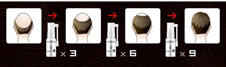 OMY LADY Anti Hair Loss Hair Growth Spray Essential Oil Liquid For Men Women Dry Hair Regeneration Repair,Hair Loss Products OMY LADY Anti Hair Loss Hair Growth Spray Essential Oil Liquid For Men Women Dry Hair Regeneration Repair,Hair Loss Products