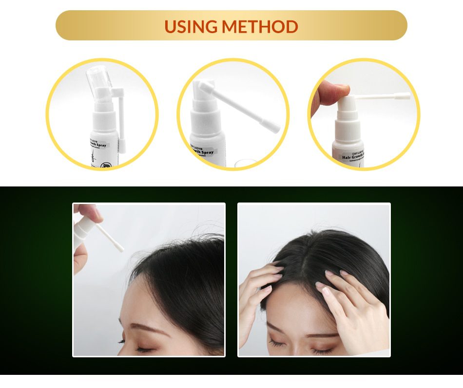 OMY LADY Anti Hair Loss Hair Growth Spray Essential Oil Liquid For Men Women Dry Hair Regeneration Repair,Hair Loss Products OMY LADY Anti Hair Loss Hair Growth Spray Essential Oil Liquid For Men Women Dry Hair Regeneration Repair,Hair Loss Products