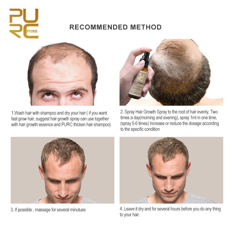 New PURC 30ml Hair Growth Spray Ginger Essence Spray Effective Extract Anti Hair Loss Nourish Roots For Men TSLM2