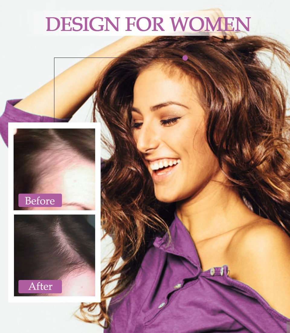 Anti Hair Loss Essence Hair Growth Treatment Oil Fast Thick Hair Eyebrows Support Natural Healthy Hair Treatment for Women Anti Hair Loss Essence Hair Growth Treatment Oil Fast Thick Hair Eyebrows Support Natural Healthy Hair Treatment for Women