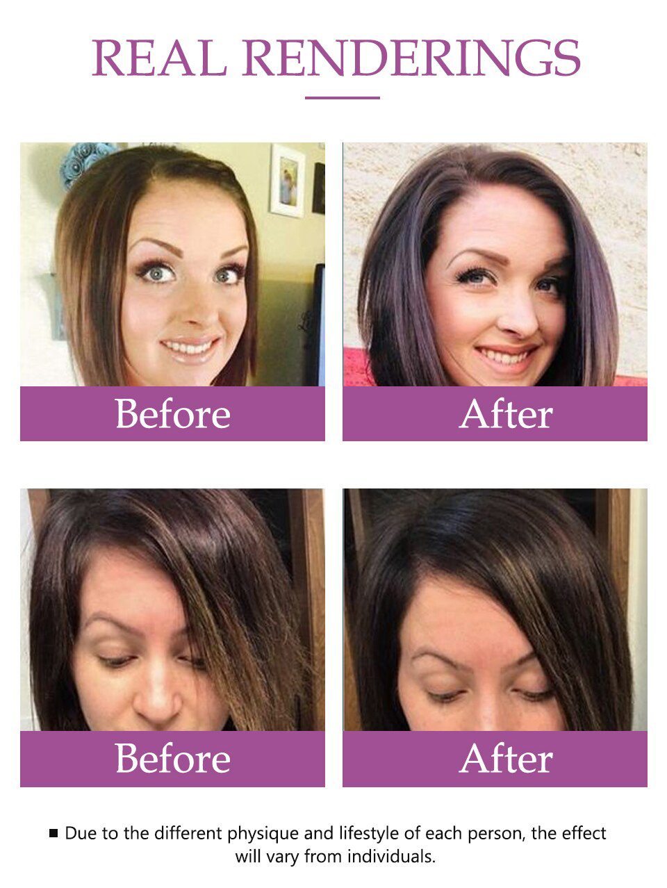 Anti Hair Loss Essence Hair Growth Treatment Oil Fast Thick Hair Eyebrows Support Natural Healthy Hair Treatment for Women Anti Hair Loss Essence Hair Growth Treatment Oil Fast Thick Hair Eyebrows Support Natural Healthy Hair Treatment for Women