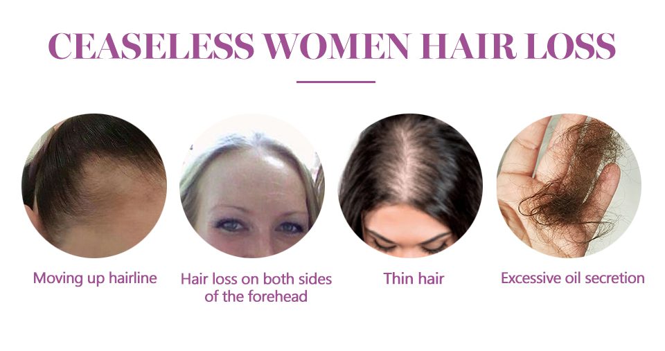 Anti Hair Loss Essence Hair Growth Treatment Oil Fast Thick Hair Eyebrows Support Natural Healthy Hair Treatment for Women Anti Hair Loss Essence Hair Growth Treatment Oil Fast Thick Hair Eyebrows Support Natural Healthy Hair Treatment for Women