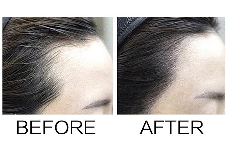 Sevich Makeup Hair Line Shadow Powder Eyebrow Powder Extract Easy to Wear Make Up neat symmetry hairline with Mirror Puff Fibers Sevich Makeup Hair Line Shadow Powder Eyebrow Powder Extract Easy to Wear Make Up neat symmetry hairline with Mirror Puff Fibers