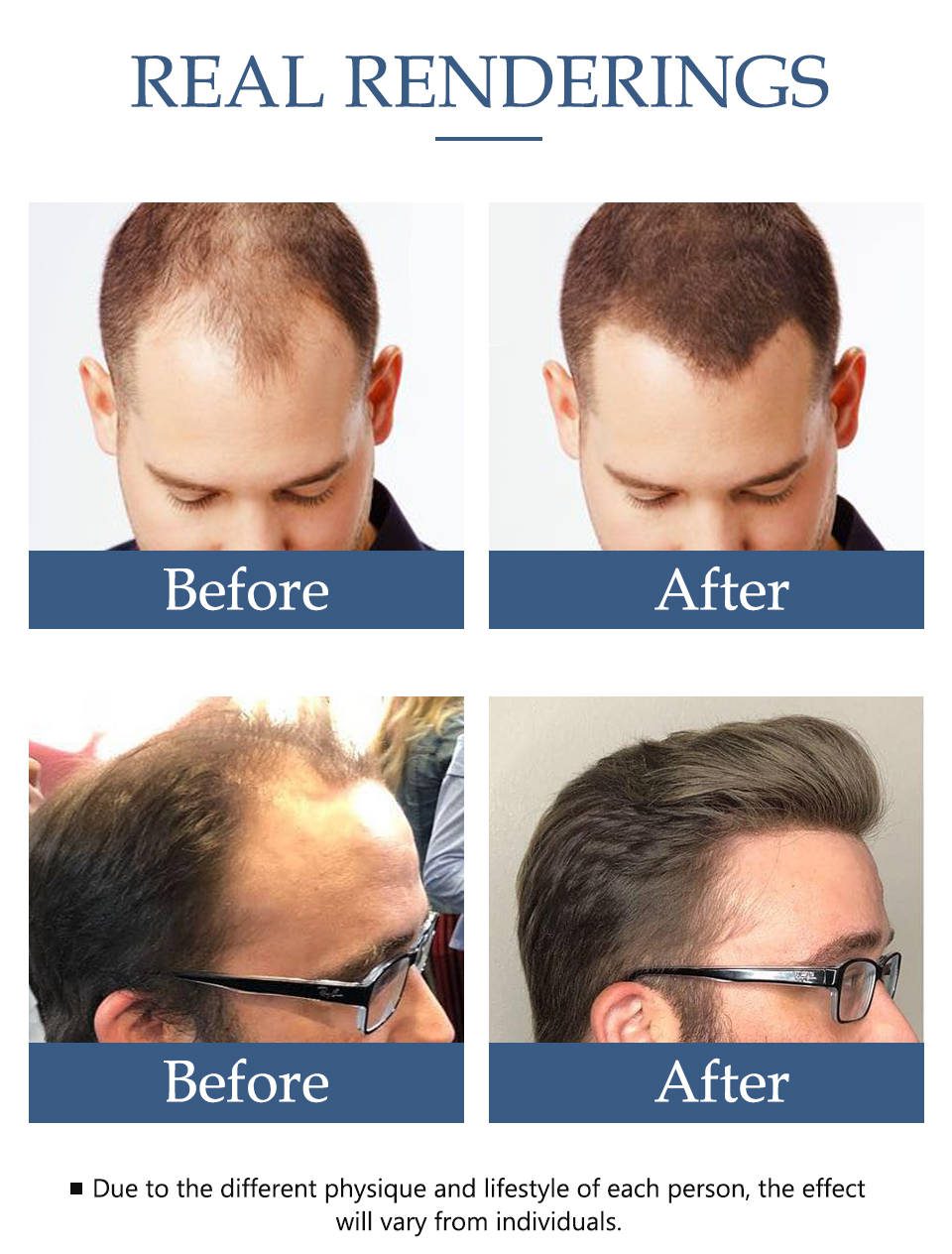 Hair Growth Essence Oil Anti Hair Loss Treatment for Beard Growth Oil Repair Damage Hair Roots Hair Care Products Hair Tonic Hair Growth Essence Oil Anti Hair Loss Treatment for Beard Growth Oil Repair Damage Hair Roots Hair Care Products Hair Tonic