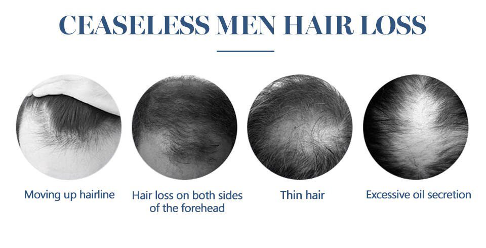 Hair Growth Essence Oil Anti Hair Loss Treatment for Beard Growth Oil Repair Damage Hair Roots Hair Care Products Hair Tonic Hair Growth Essence Oil Anti Hair Loss Treatment for Beard Growth Oil Repair Damage Hair Roots Hair Care Products Hair Tonic