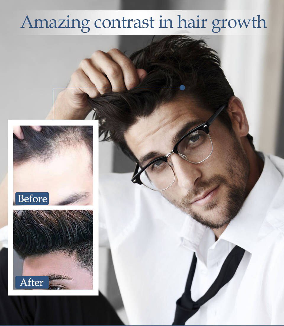 Hair Growth Essence Oil Anti Hair Loss Treatment for Beard Growth Oil Repair Damage Hair Roots Hair Care Products Hair Tonic Hair Growth Essence Oil Anti Hair Loss Treatment for Beard Growth Oil Repair Damage Hair Roots Hair Care Products Hair Tonic
