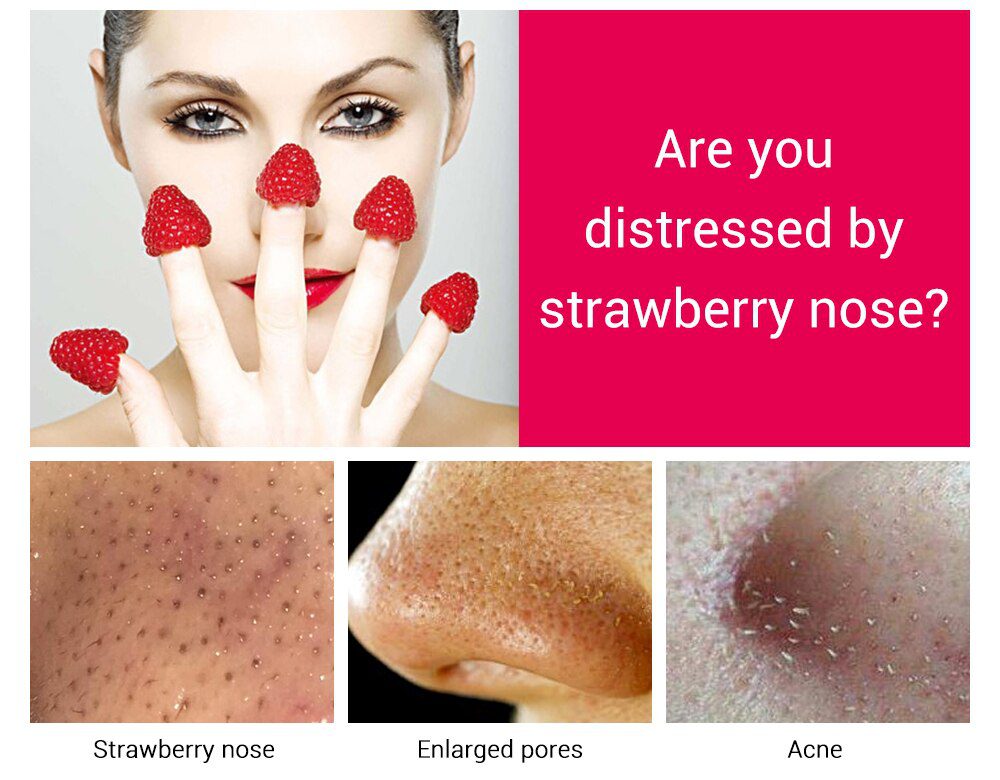 LANBENA Face Mask Strawberry Blackhead Remover Nose Mask Mud Pore Strip Black Mask Peel off Mask Acne Treatment Nose Skin Care LANBENA Face Mask Strawberry Blackhead Remover Nose Mask Mud Pore Strip Black Mask Peel off Mask Acne Treatment Nose Skin Care