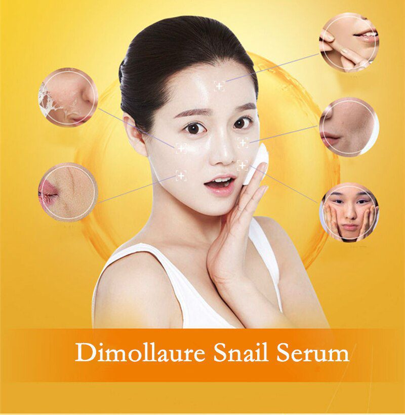 Dimollaure 30g pure Kojic Acid whitening cream+Kojic Acid serum Wrinkle removal Freckle melasma Acne scar pigmentt melanin cream Dimollaure 30g pure Kojic Acid whitening cream+Kojic Acid serum Wrinkle removal Freckle melasma Acne scar pigmentt melanin cream