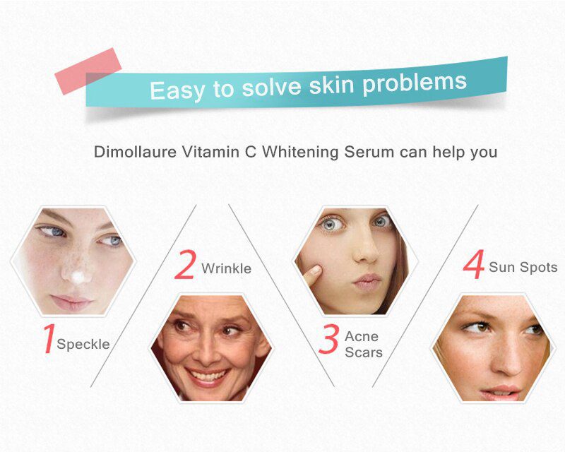 Dimollaure 30g pure Kojic Acid whitening cream+Kojic Acid serum Wrinkle removal Freckle melasma Acne scar pigmentt melanin cream Dimollaure 30g pure Kojic Acid whitening cream+Kojic Acid serum Wrinkle removal Freckle melasma Acne scar pigmentt melanin cream
