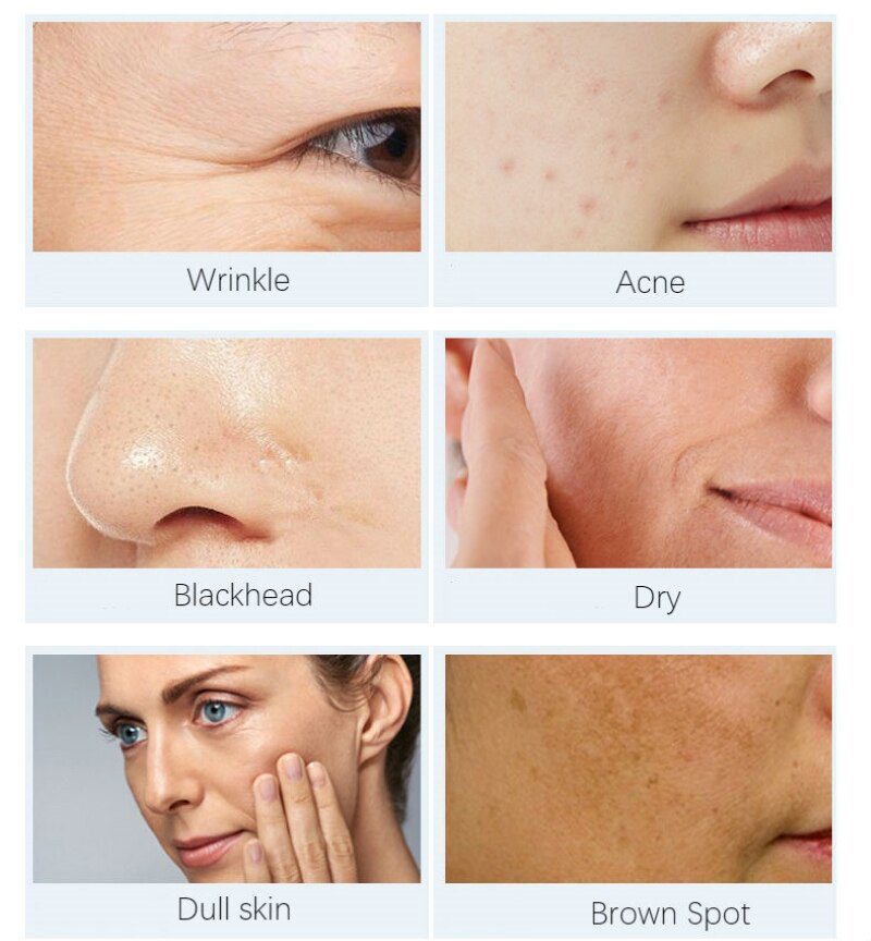 Dimollaure whitening Freckle cream+Fullerene 24k Gold Serum Anti-aging wrinkle Serum Removal melasma sunburn brown spot melanin Dimollaure whitening Freckle cream+Fullerene 24k Gold Serum Anti-aging wrinkle Serum Removal melasma sunburn brown spot melanin