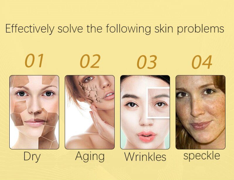 Dimollaure whitening Freckle cream+Fullerene 24k Gold Serum Anti-aging wrinkle Serum Removal melasma sunburn brown spot melanin Dimollaure whitening Freckle cream+Fullerene 24k Gold Serum Anti-aging wrinkle Serum Removal melasma sunburn brown spot melanin