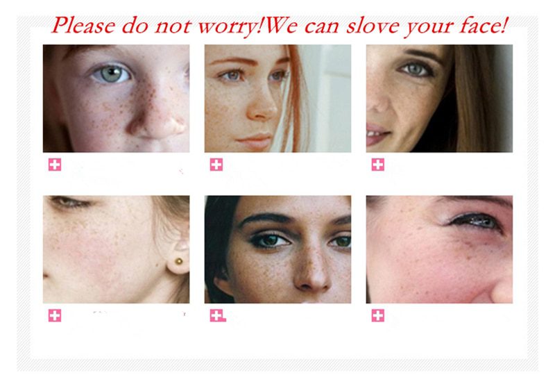 Dimollaure Retinol whitening face cream +Vitamin C serum Acne treament Remove Freckle melasma pigment Melanin sunburn Spots Dimollaure Retinol whitening face cream +Vitamin C serum Acne treament Remove Freckle melasma pigment Melanin sunburn Spots