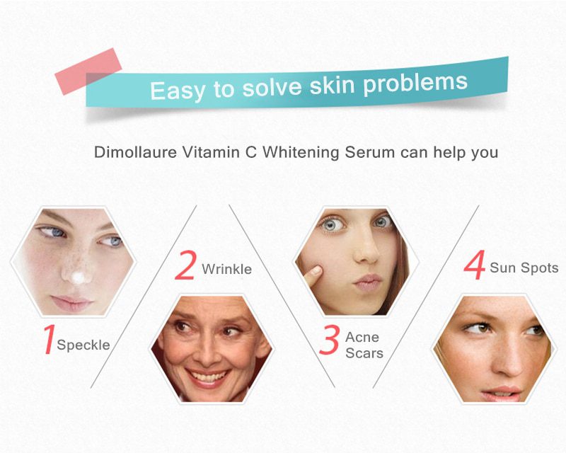 Dimollaure kojic acid Retinol whitening cream Vitamin C peptides Argireline serum Remov Freckle melasma pigment Melanin darkSpot Dimollaure kojic acid Retinol whitening cream Vitamin C peptides Argireline serum Remov Freckle melasma pigment Melanin darkSpot