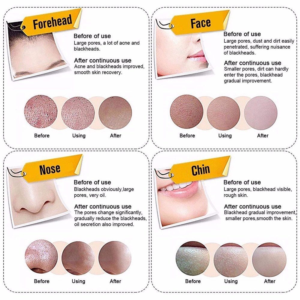 Mabox Black Mask Peel Off Bamboo Charcoal Purifying Blackhead Remover Mask Deep Cleansing for AcneScars Blemishes WrinklesFacial