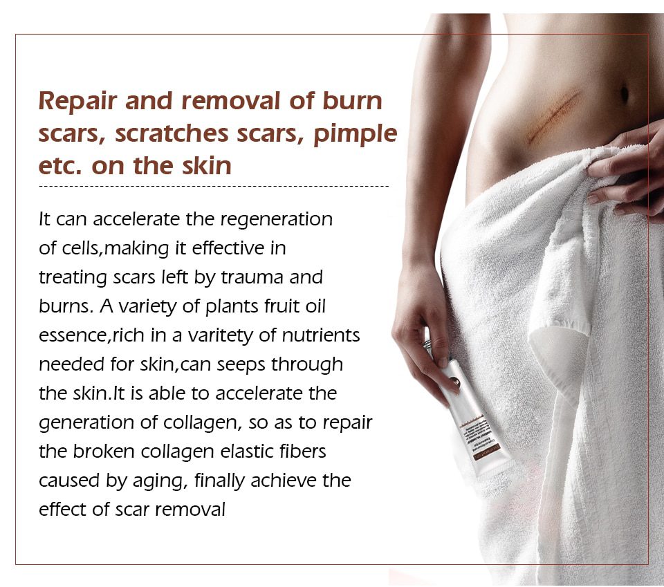 VIBRANT GLAMOUR Repair Scar Removal Cream Acne Scars Gel Stretch Marks Surgical Scar Burn For Body Pigmentation Corrector Care VIBRANT GLAMOUR Repair Scar Removal Cream Acne Scars Gel Stretch Marks Surgical Scar Burn For Body Pigmentation Corrector Care