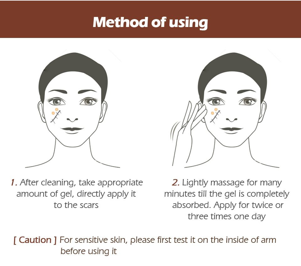 VIBRANT GLAMOUR Repair Scar Removal Cream Acne Scars Gel Stretch Marks Surgical Scar Burn For Body Pigmentation Corrector Care VIBRANT GLAMOUR Repair Scar Removal Cream Acne Scars Gel Stretch Marks Surgical Scar Burn For Body Pigmentation Corrector Care