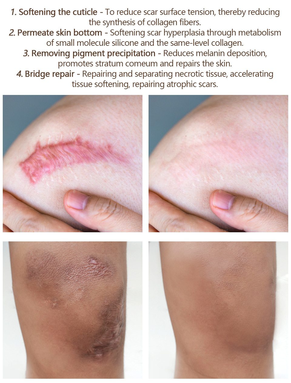 VIBRANT GLAMOUR Repair Scar Removal Cream Acne Scars Gel Stretch Marks Surgical Scar Burn For Body Pigmentation Corrector Care VIBRANT GLAMOUR Repair Scar Removal Cream Acne Scars Gel Stretch Marks Surgical Scar Burn For Body Pigmentation Corrector Care