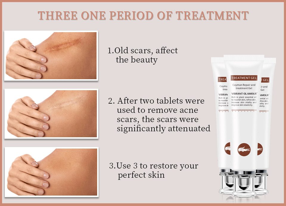 VIBRANT GLAMOUR Repair Scar Removal Cream Acne Scars Gel Stretch Marks Surgical Scar Burn For Body Pigmentation Corrector Care VIBRANT GLAMOUR Repair Scar Removal Cream Acne Scars Gel Stretch Marks Surgical Scar Burn For Body Pigmentation Corrector Care