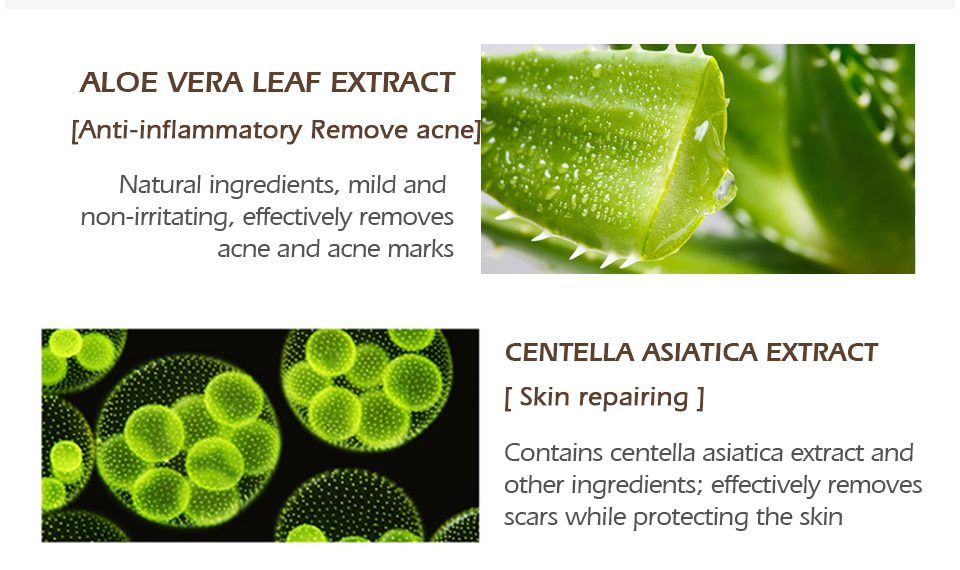 VIBRANT GLAMOUR Repair Scar Removal Cream Acne Scars Gel Stretch Marks Surgical Scar Burn For Body Pigmentation Corrector Care VIBRANT GLAMOUR Repair Scar Removal Cream Acne Scars Gel Stretch Marks Surgical Scar Burn For Body Pigmentation Corrector Care