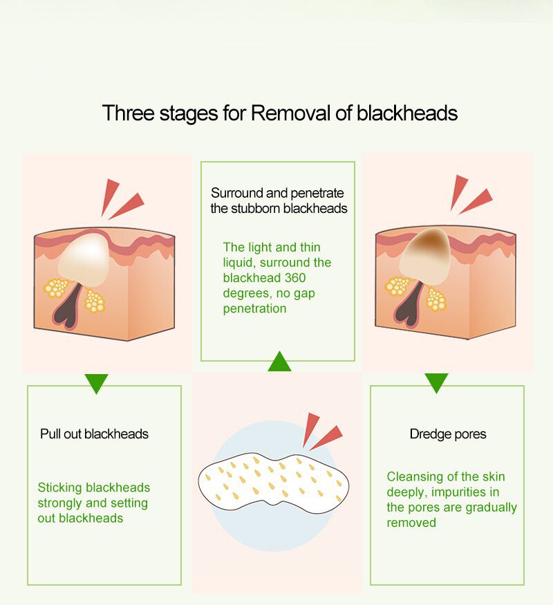 ROSALIND Face Masks Facial From Black Dots Remove Blackhead Acne Nose Peeling Fabric Mask For The Face Lifting Cream Skin Care ROSALIND Face Masks Facial From Black Dots Remove Blackhead Acne Nose Peeling Fabric Mask For The Face Lifting Cream Skin Care