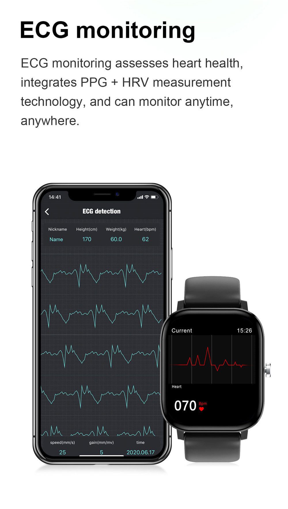 1.75 Inch IPS Screen Smart Watch Men Women ECG Heart Rate Blood Pressure Monitor Smartwatch Waterproof Watch For Android Iphone 1.75 Inch IPS Screen Smart Watch Men Women ECG Heart Rate Blood Pressure Monitor Smartwatch Waterproof Watch For Android Iphone