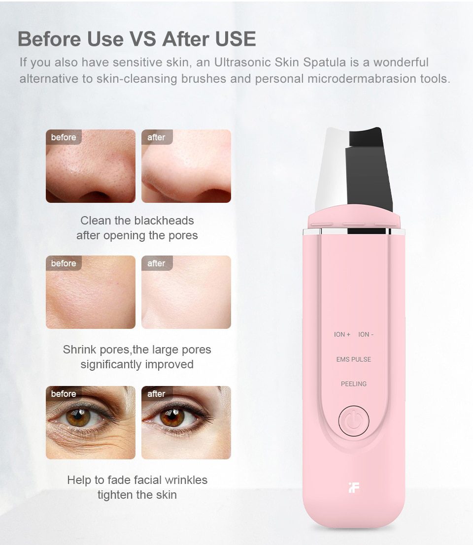 InFace Ultrasonic Facial Skin Scrubber Cleaner Ion Acne Blackhead Remover Peeling Shovel Cleaner Facial Massager Skin Care InFace Ultrasonic Facial Skin Scrubber Cleaner Ion Acne Blackhead Remover Peeling Shovel Cleaner Facial Massager Skin Care