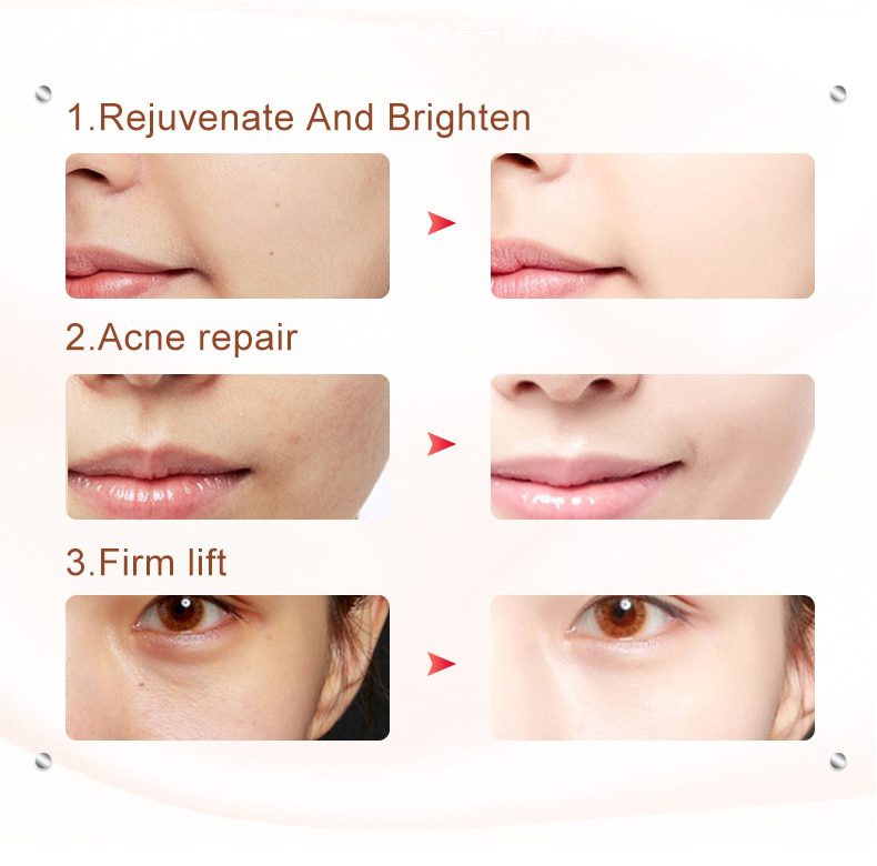 AmazeFan7in1RF&EMS Radio Mesotherapy Electroporation lifting Beauty LED Face Skin Rejuvenation Remover Wrinkle Radio Frequency AmazeFan7in1RF&EMS Radio Mesotherapy Electroporation lifting Beauty LED Face Skin Rejuvenation Remover Wrinkle Radio Frequency