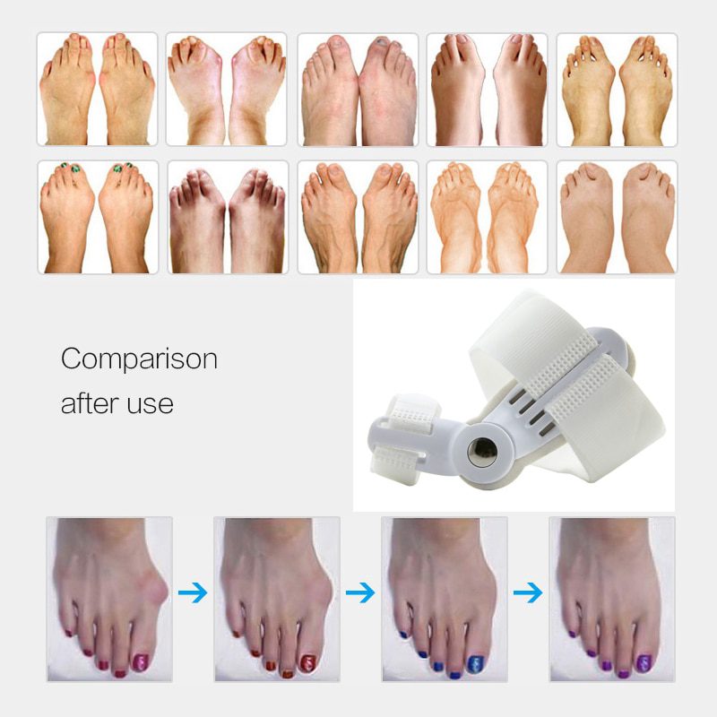 USA 2Pcs Toe Protector Feet Care Pedicure Tool Bunion Hallux Valgus Corrector Orthopedic Supplies Big Toe Splint Straightener USA 2Pcs Toe Protector Feet Care Pedicure Tool Bunion Hallux Valgus Corrector Orthopedic Supplies Big Toe Splint Straightener