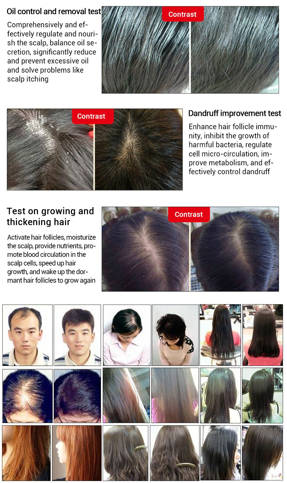 AMEIZII Andrea 20ml Ginger Extract Dense Hair Fast Sunburst Hair Growth Essence Restoration Hair Loss Liquid Serum Hair Care Oil AMEIZII Andrea 20ml Ginger Extract Dense Hair Fast Sunburst Hair Growth Essence Restoration Hair Loss Liquid Serum Hair Care Oil