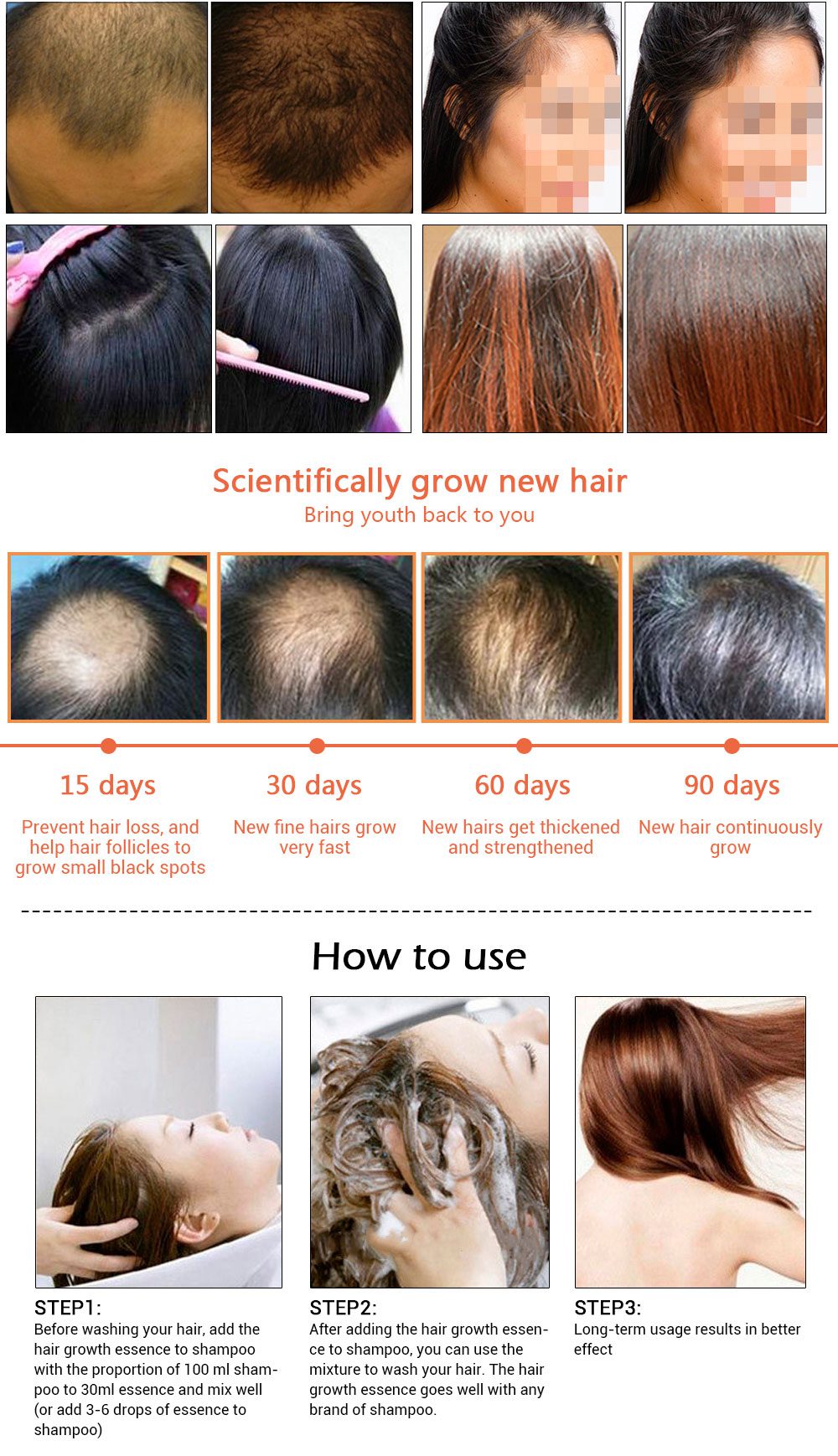 AMEIZII Andrea 20ml Ginger Extract Dense Hair Fast Sunburst Hair Growth Essence Restoration Hair Loss Liquid Serum Hair Care Oil AMEIZII Andrea 20ml Ginger Extract Dense Hair Fast Sunburst Hair Growth Essence Restoration Hair Loss Liquid Serum Hair Care Oil