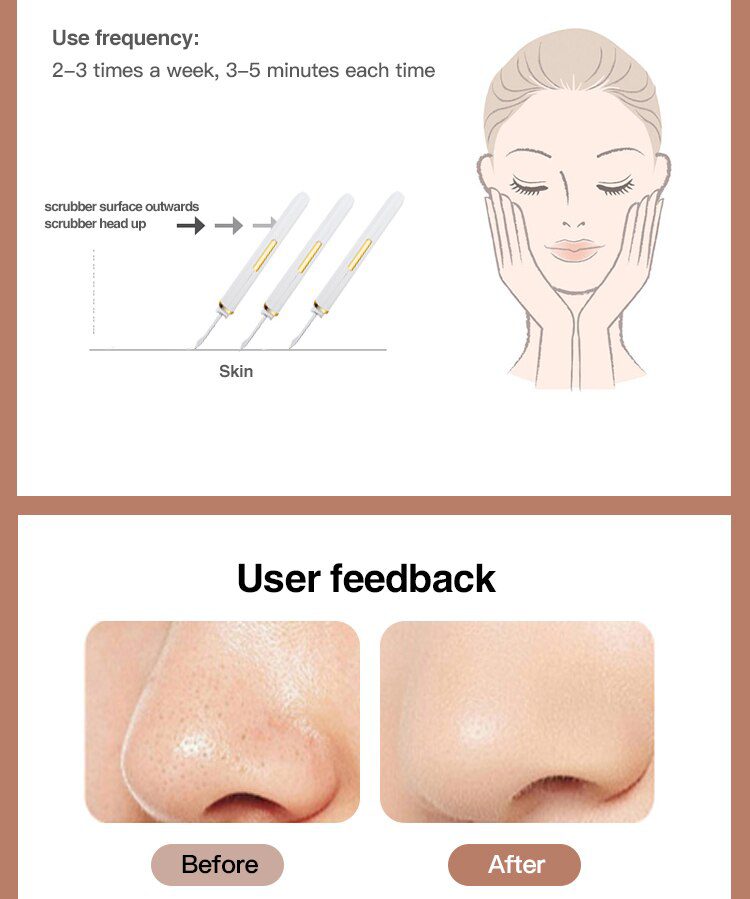 Ultrasonic Skin Scrubber Vibration Face Spatula Blackhead Remover Facial Scrubber Shovel Clean Cavitation Peeling Facial Lifting
