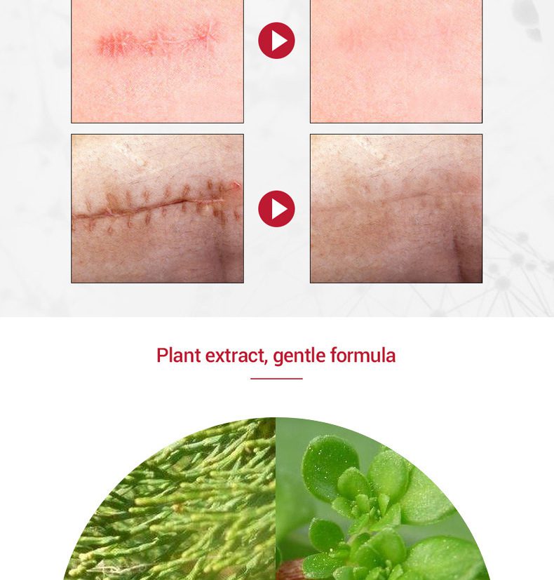 MEIKING Dark Spot Corrector Skin Whitening Fade Cream Lightening Blemish Removal Serum Reduces Age Spots Freckles Melasma Cream MEIKING Dark Spot Corrector Skin Whitening Fade Cream Lightening Blemish Removal Serum Reduces Age Spots Freckles Melasma Cream