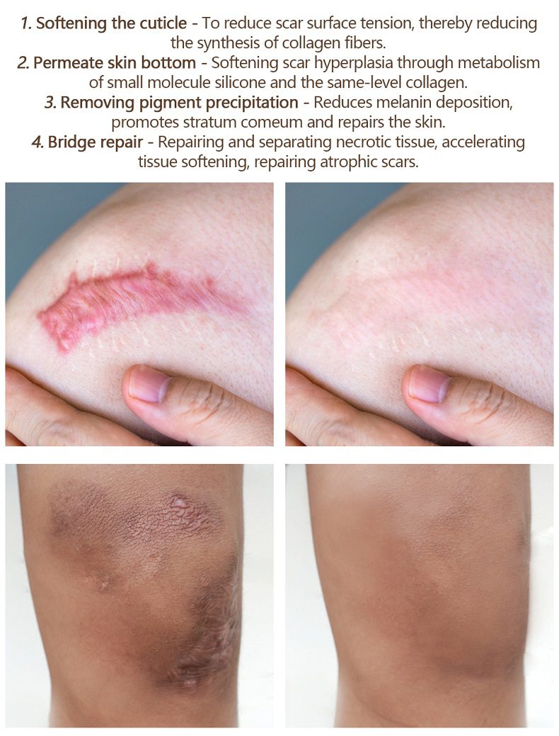 MEIKING Dark Spot Corrector Skin Whitening Fade Cream Lightening Blemish Removal Serum Reduces Age Spots Freckles Melasma Cream MEIKING Dark Spot Corrector Skin Whitening Fade Cream Lightening Blemish Removal Serum Reduces Age Spots Freckles Melasma Cream