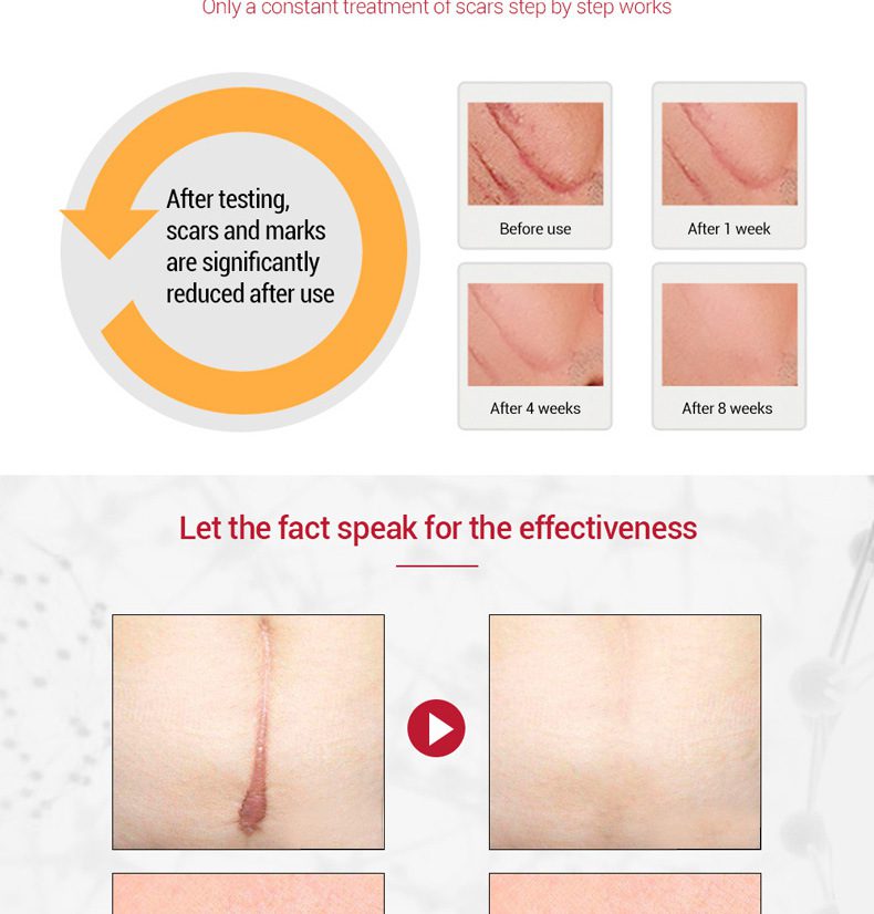 MEIKING Dark Spot Corrector Skin Whitening Fade Cream Lightening Blemish Removal Serum Reduces Age Spots Freckles Melasma Cream MEIKING Dark Spot Corrector Skin Whitening Fade Cream Lightening Blemish Removal Serum Reduces Age Spots Freckles Melasma Cream