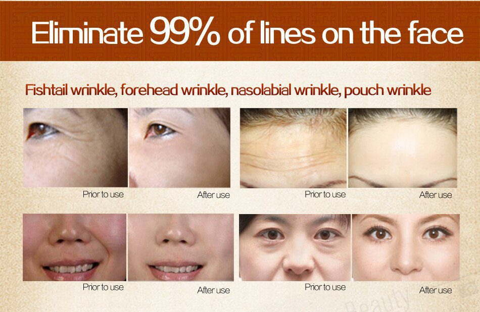 MEIKING Collagen Essence Oil Face Serum Repair Skin Care Anti Aging Anti Wrinkle Acne Treatment Whitening Moisturizer MEIKING Collagen Essence Oil Face Serum Repair Skin Care Anti Aging Anti Wrinkle Acne Treatment Whitening Moisturizer