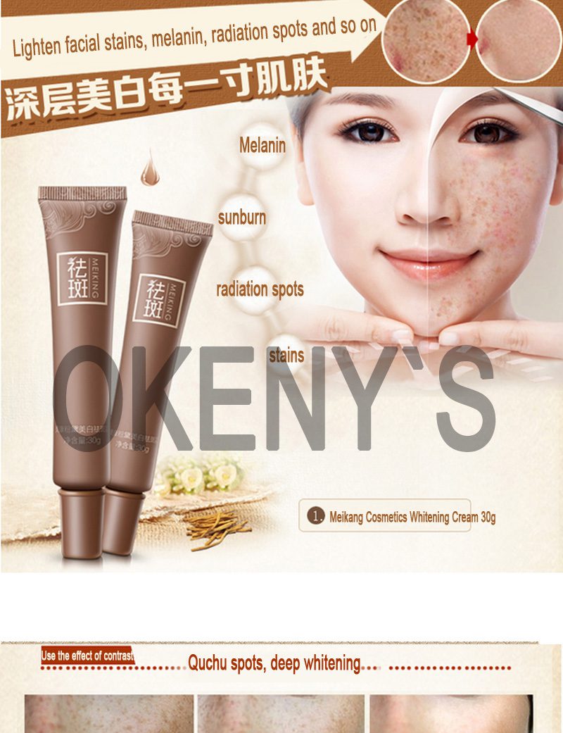 MEIKING Dark Spot Corrector Skin Whitening Fade Cream Lightening Blemish Removal Serum Reduces Age Spots Freckles Melasma cream MEIKING Dark Spot Corrector Skin Whitening Fade Cream Lightening Blemish Removal Serum Reduces Age Spots Freckles Melasma cream