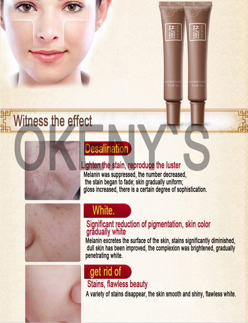 MEIKING Dark Spot Corrector Skin Whitening Fade Cream Lightening Blemish Removal Serum Reduces Age Spots Freckles Melasma cream MEIKING Dark Spot Corrector Skin Whitening Fade Cream Lightening Blemish Removal Serum Reduces Age Spots Freckles Melasma cream