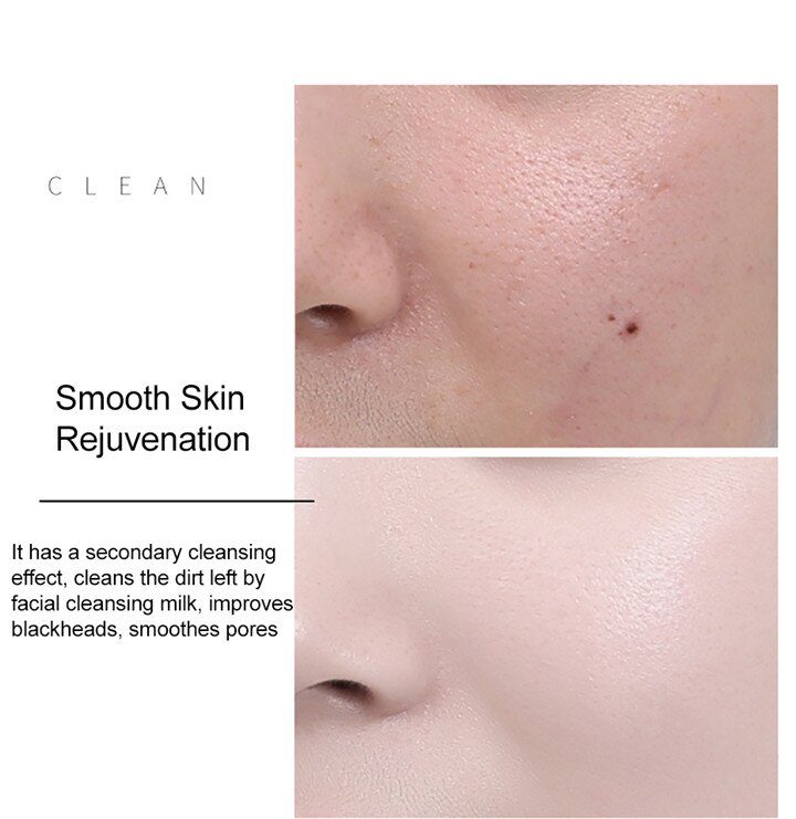 LAIKOU 24k Gold Face Serum Hyaluronic Acid Serum Moisturizer Essence Cream Whitening Day Creams Anti Aging Anti Wrinkle Acne Art LAIKOU 24k Gold Face Serum Hyaluronic Acid Serum Moisturizer Essence Cream Whitening Day Creams Anti Aging Anti Wrinkle Acne Art