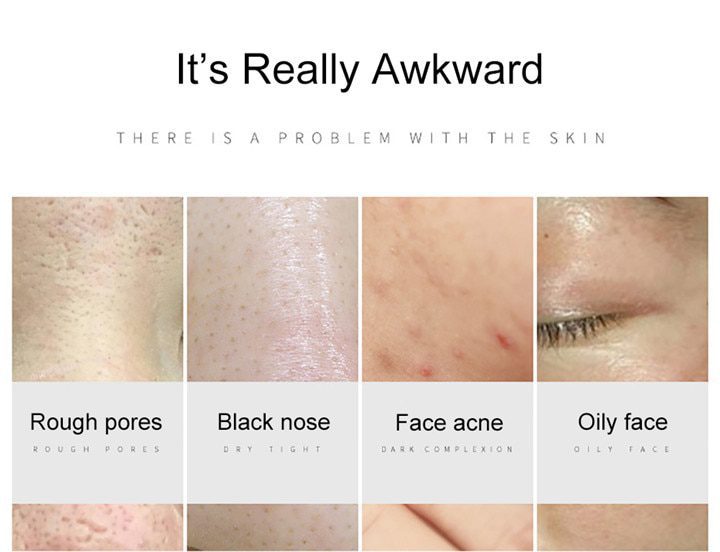 LAIKOU 24k Gold Face Serum Hyaluronic Acid Serum Moisturizer Essence Cream Whitening Day Creams Anti Aging Anti Wrinkle Acne Art LAIKOU 24k Gold Face Serum Hyaluronic Acid Serum Moisturizer Essence Cream Whitening Day Creams Anti Aging Anti Wrinkle Acne Art